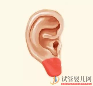 耳朵長(zhǎng)這樣的人更長(zhǎng)壽，這次中西醫(yī)觀點(diǎn)一致(圖4)