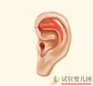 耳朵長(zhǎng)這樣的人更長(zhǎng)壽，這次中西醫(yī)觀點(diǎn)一致(圖8)