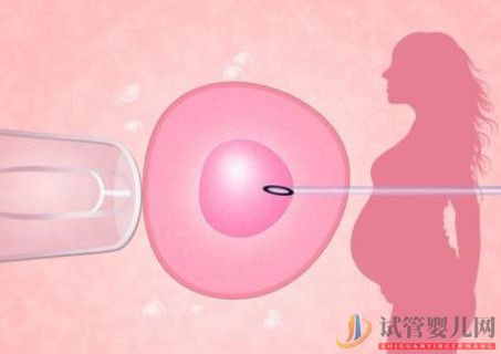 三代試管的促排方案有很多種，要怎么選擇？試管嬰兒怎么做的全過程(圖1)