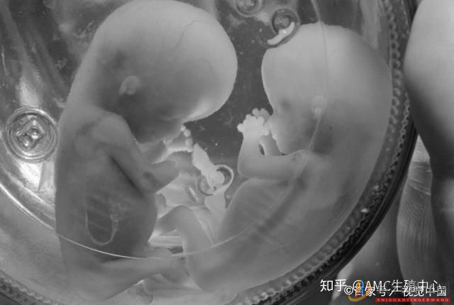西昌試管嬰兒和普通嬰兒有什么區別(圖5)