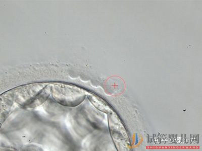 試管嬰兒成功必備的自身?xiàng)l件有什么(試管嬰兒身體要求)試管嬰兒多少錢(圖1) 試管嬰兒成功必備的自身?xiàng)l件有什么?(圖1)