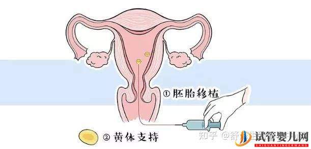 一個試管嬰兒周期多長時間,具體流程怎么樣(圖10)