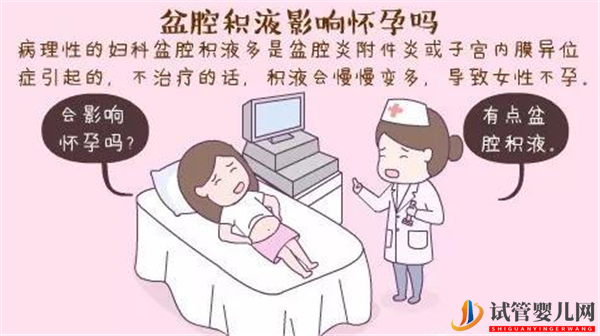 什么是盆腔積液_對俄羅斯試管嬰兒胚胎移植有哪些影響(圖1)