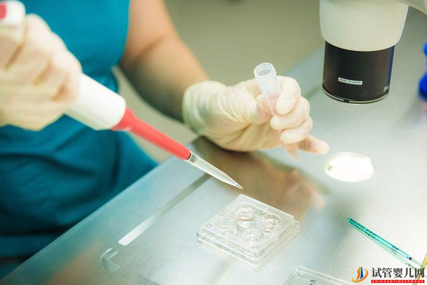 試管嬰兒取卵的過程！(圖1)