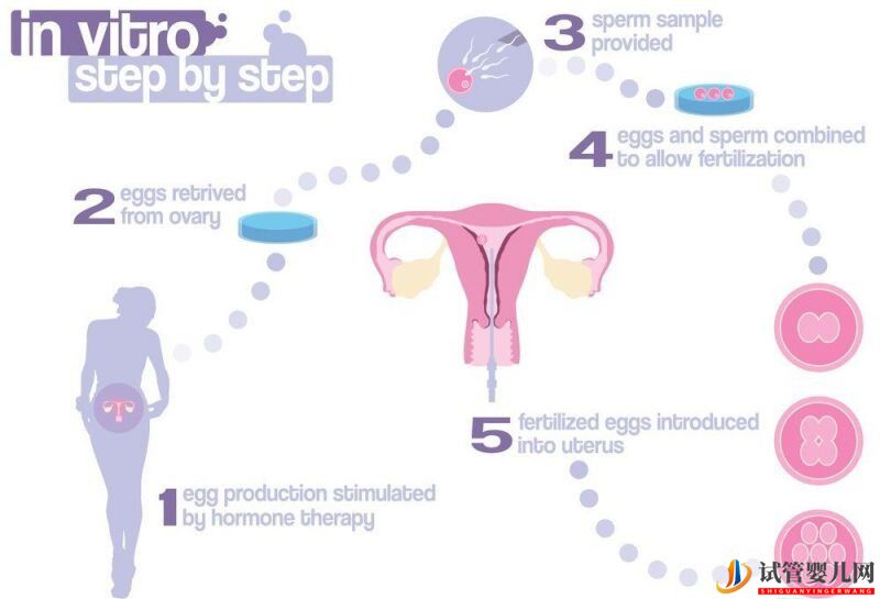試管嬰兒全過(guò)程是怎樣的？什么是試管嬰兒？(圖1)