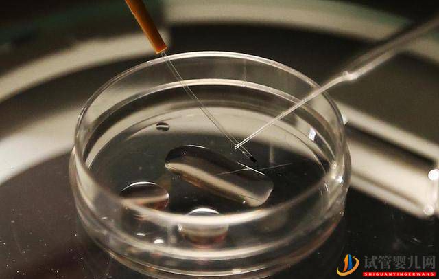 試管嬰兒真的那么容易嗎？8張圖為你播放全過程(圖1)