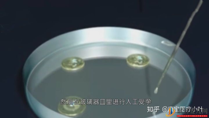 做試管嬰兒有多痛,幾張3D模擬圖,看完全過程后心(圖5)