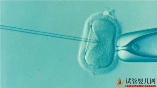 試管嬰兒的成功率有多高呢(圖1)