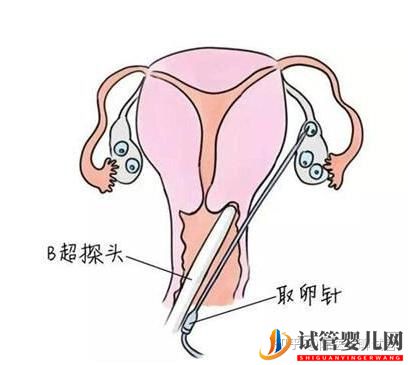 女性太偉大了!試管嬰兒全過程操作步驟(圖2)