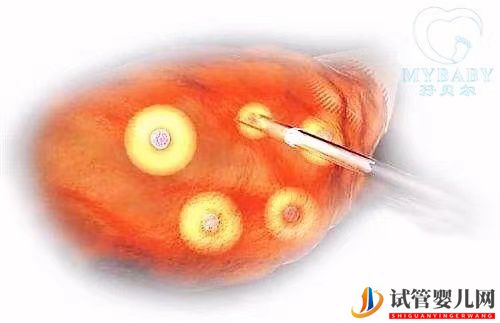 試管嬰兒取卵，數量越多成功率越高嗎(圖1)