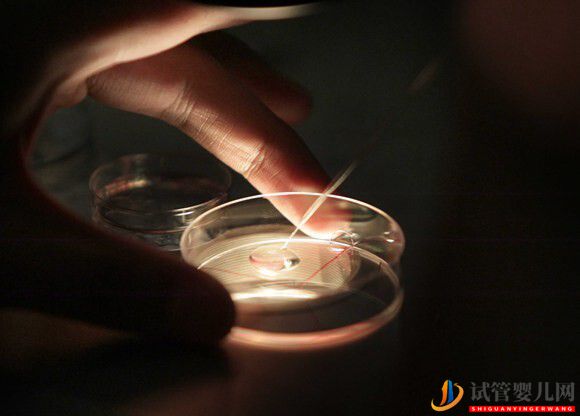 試管嬰兒移植對子宮內膜要求是怎樣的？(圖1)