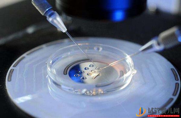 俄羅斯試管嬰兒養囊胚是怎樣的？(圖1)