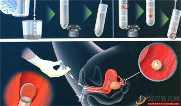 哪幾類女性通過試管嬰兒移植的成功率高(圖1)