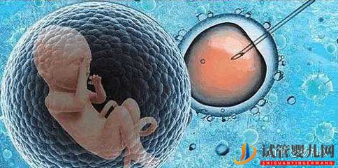 格魯吉亞試管嬰兒了解基本常識(圖1)