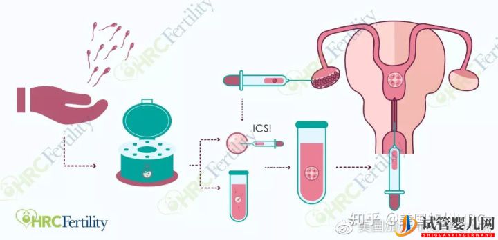 原來美國試管是這樣的美國試管(圖4)