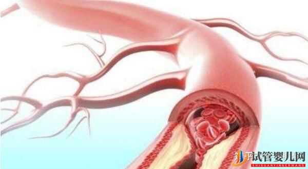 美國試管專家講解人工授精和試管嬰兒的區別(圖11)