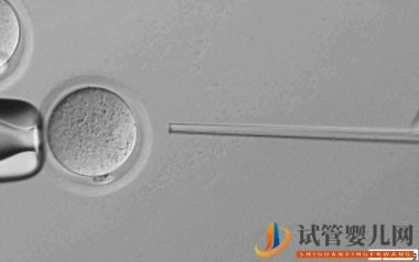 泰國試管高達(dá)70%的成功率,做到5點(圖5)