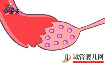 試管嬰兒促排和取卵(圖2)