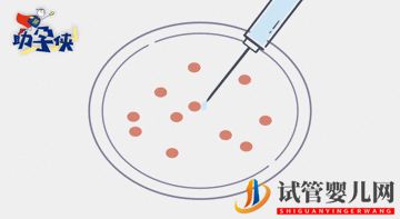 試管嬰兒促排和取卵(圖4)