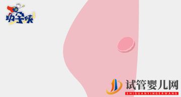 試管嬰兒促排和取卵(圖5)