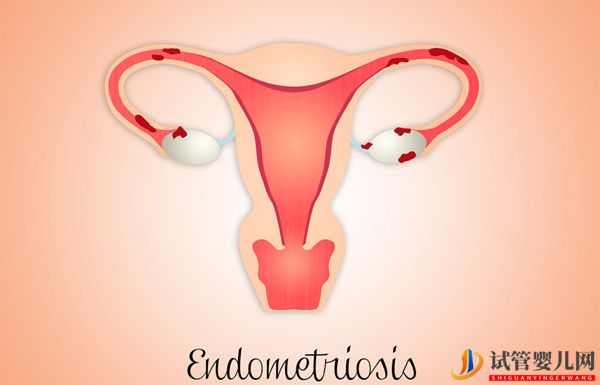 子宮內(nèi)膜厚度對(duì)美國(guó)試管嬰兒移植的影響,如何保養(yǎng)?(圖1) 子宮內(nèi)膜厚度對(duì)美國(guó)試管嬰兒移植的影響,如何保養(yǎng)?(圖1)