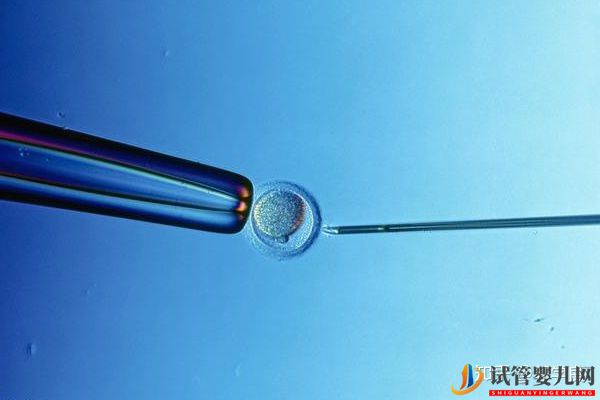 美國試管嬰兒方案制定依據(jù)各環(huán)節(jié)具體操作及重點(diǎn)(圖2)