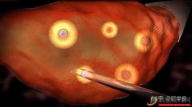 美國試管嬰兒方案制定依據(jù)各環(huán)節(jié)具體操作及重點(diǎn)(圖6)