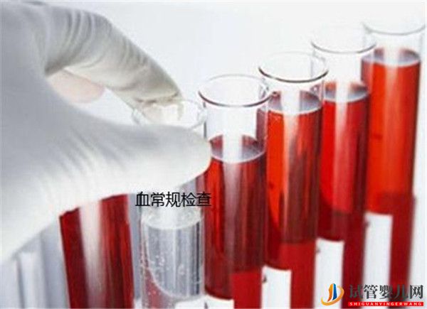 在試管嬰兒前女性需要做哪些基本檢查(圖1)