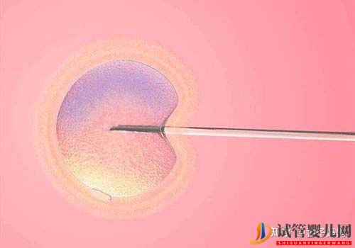 美國第三代試管嬰兒技術可以解決什么問題(圖3)