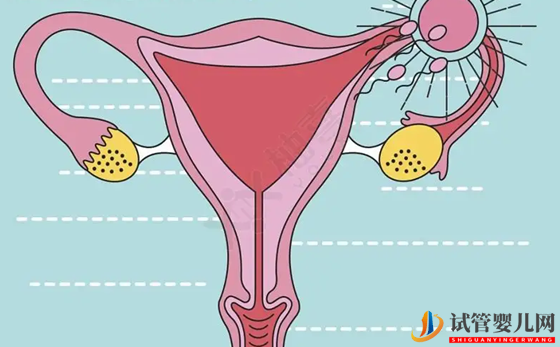 雙側卵巢多囊能懷孕嗎 雙側卵巢多囊原因是什么(圖1)
