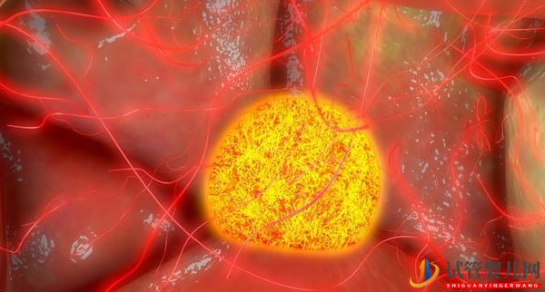 過度節食減肥很傷“卵”-去美國做試管嬰兒前吃出好卵子(圖1)