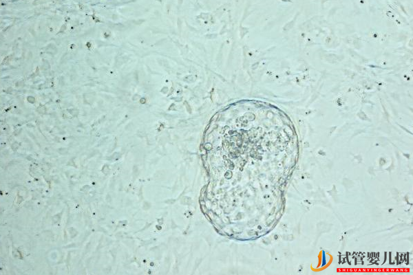 教您避免美國試管嬰兒“無囊胚可用”的情況(圖1)