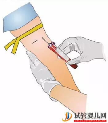 試管周期是什么意思_一個周期要多久(圖3)