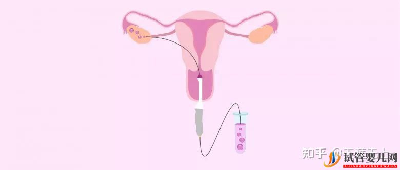 試管周期是什么意思_一個周期要多久(圖8)