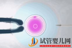 做試管嬰兒到底要花多少錢_幾萬和十幾萬有什么區別(圖10)