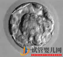 美國試管嬰兒_這樣的囊胚才是極好的(圖9)