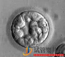 美國試管嬰兒_這樣的囊胚才是極好的(圖12)