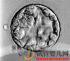 美國試管嬰兒_這樣的囊胚才是極好的(圖17)