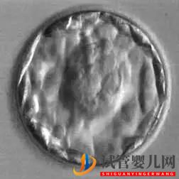 美國試管嬰兒_這樣的囊胚才是極好的(圖20)