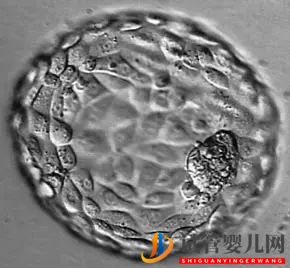 美國試管嬰兒_這樣的囊胚才是極好的(圖27)