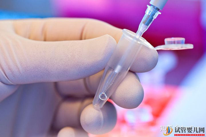 試管嬰兒大揭秘,取卵疼不疼(圖3)