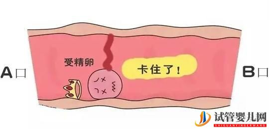 輸卵管堵塞還想懷寶寶!能夠做泰國試管嬰兒嗎(圖3)