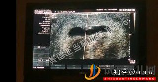 試管嬰兒寶寶VS自然受孕寶寶(圖2)