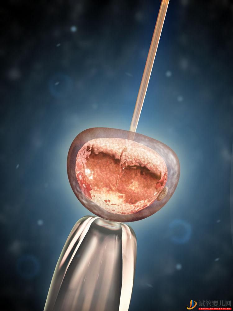 試管嬰兒成功關鍵看這幾點(圖1)