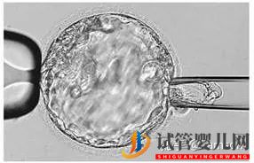 第三代試管嬰兒真的最好最先進嗎_國內哪里可以做(圖5)