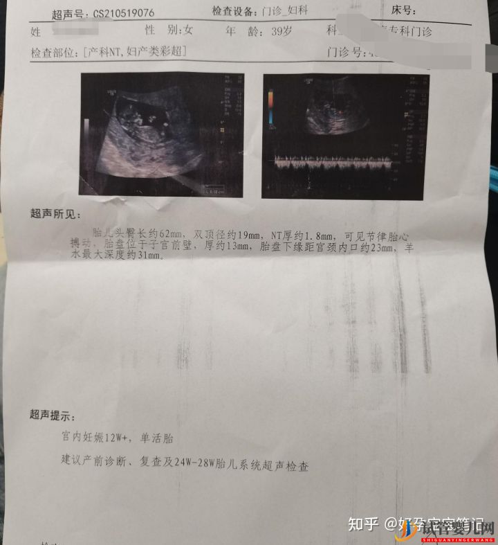 高齡不孕,做試管嬰兒一次成功的心得!經驗分享(圖3)