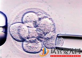 三代試管知男女的必經之路—胚胎活檢術(圖3)