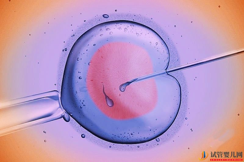 不孕，試管嬰兒和人工授精應該選擇哪一個？(圖3)