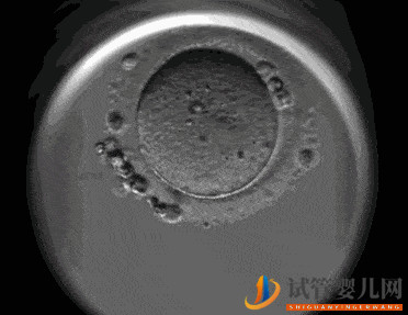 揭陽試管嬰兒醫(yī)院引進(jìn)“時(shí)差培養(yǎng)箱”，助力篩選更具發(fā)育潛力的胚胎(圖2)