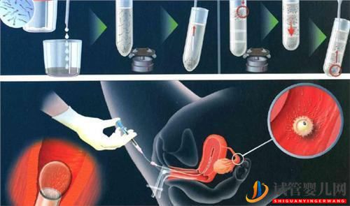 做試管期間可以喝蜂蜜水嗎(圖1)